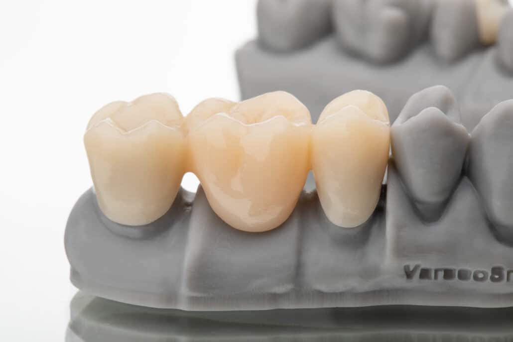 VarseoSmile TriniQ BLO_5751