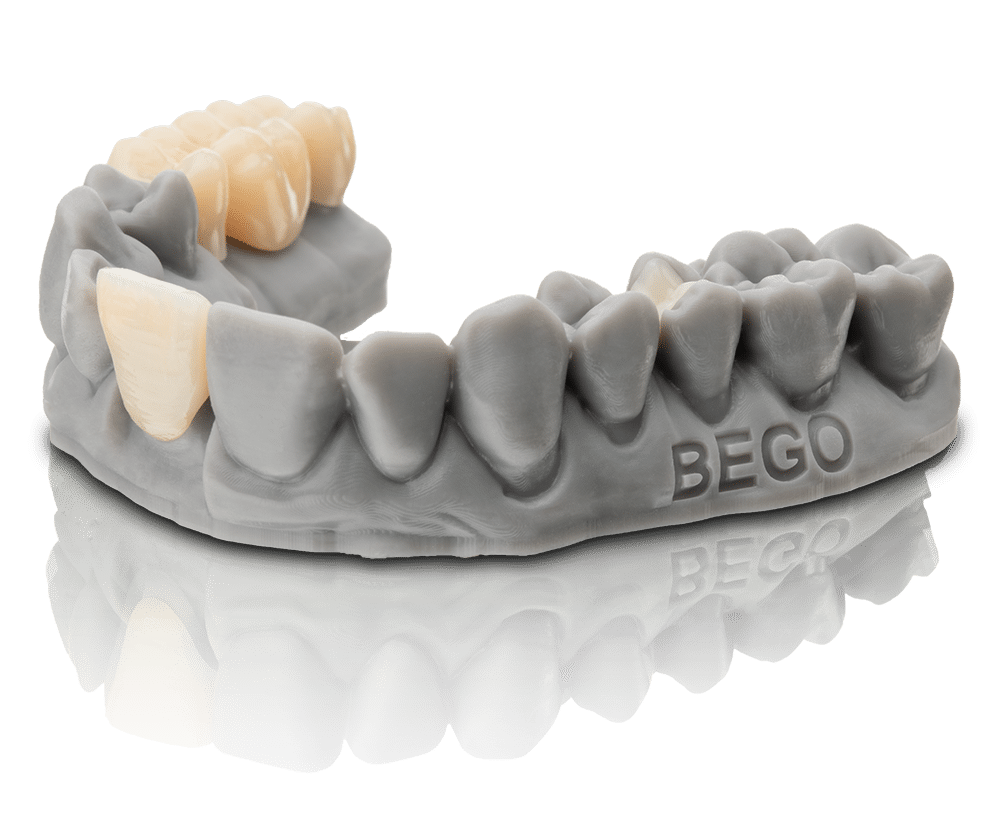 VarseoSmile-TriniQ-BLO_5772