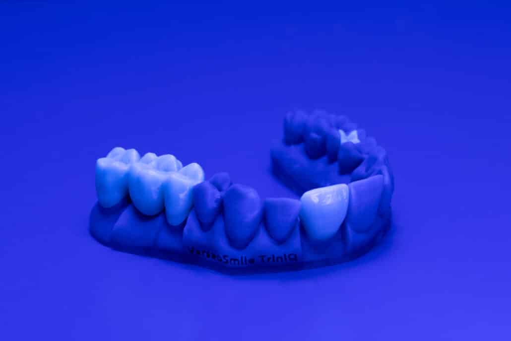 VarseoSmile TriniQ UV BLO_7670