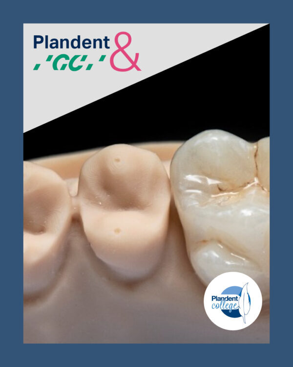 🦷 𝗥𝗲𝘀𝘁𝗮𝘂𝗿𝗮𝘁𝗶𝗲𝘀, 𝘀𝗹𝗶𝗺𝗺𝗲 𝘁𝗲𝗰𝗵𝗻𝗶𝗲𝗸𝗲𝗻 𝗲𝗻 𝗲𝗲𝗻 𝗳𝗹𝗶𝗻𝗸𝗲 𝗱𝗼𝘀𝗶𝘀 𝗶𝗻𝘀𝗽𝗶𝗿𝗮𝘁𝗶𝗲? Die vind je in november tijdens…